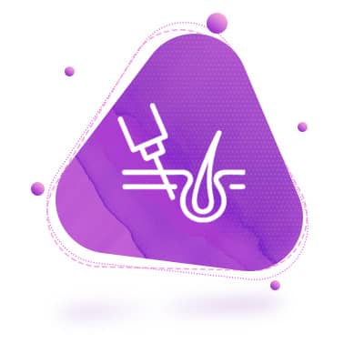 هیرفیلر